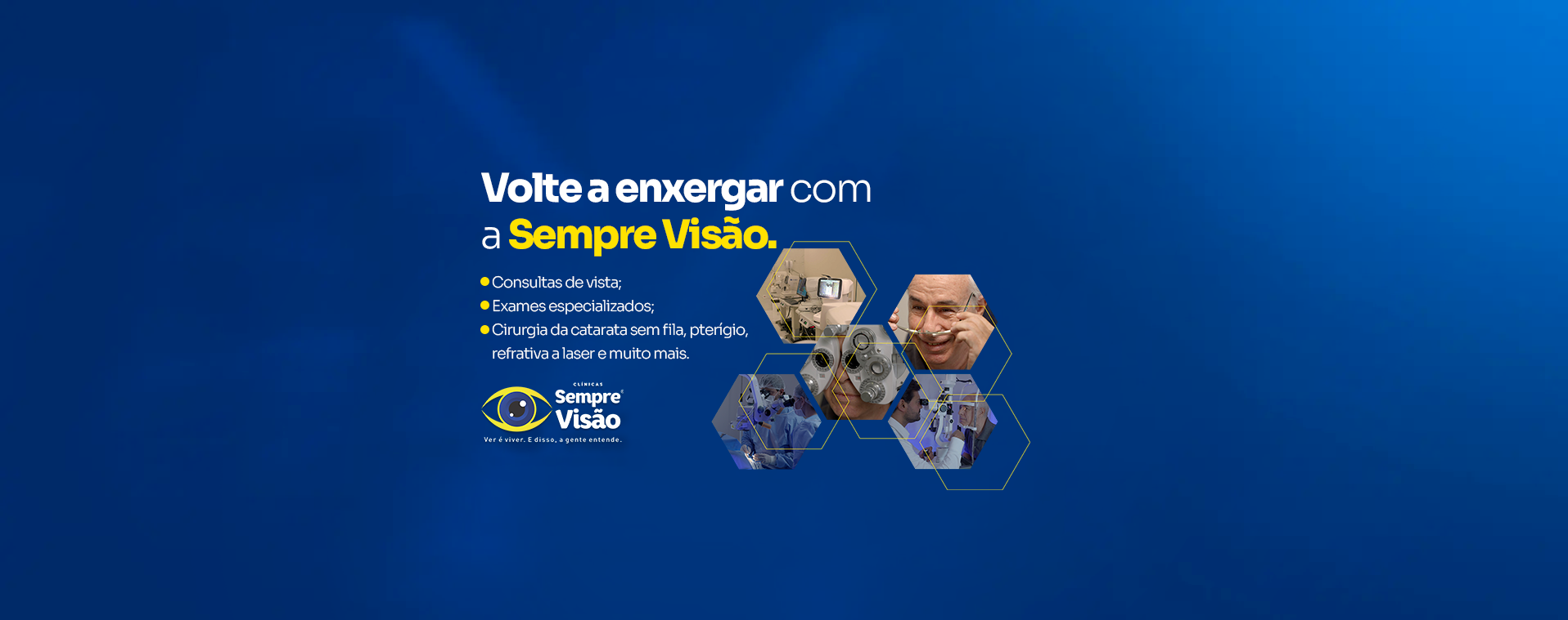 Banner Sempre Visão 3