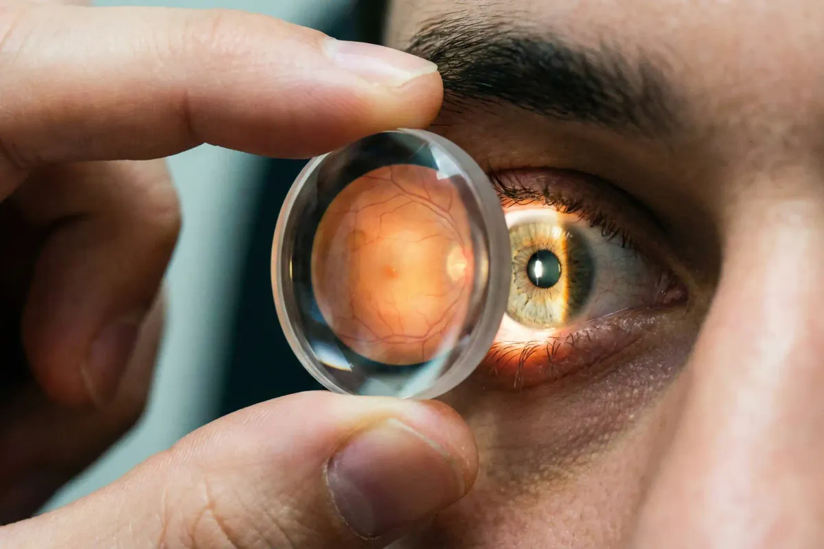 Pterígio: Tudo sobre a Cirurgia de "Carne Crescida" nos Olhos