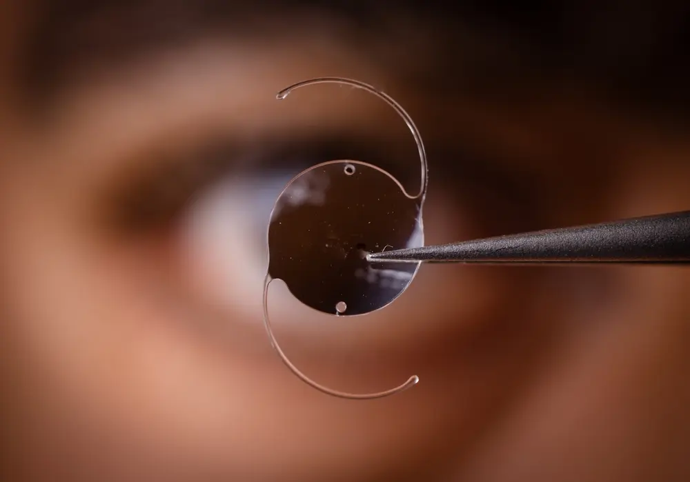 Cirurgia de Catarata (Facectomia com LIO Dobrável): O Guia Definitivo para Voltar a Ver o Mundo com Nitidez