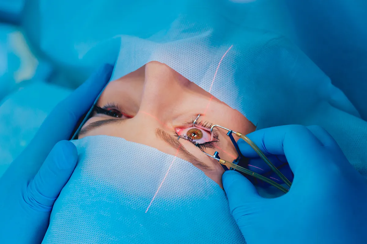 Cirurgia Refrativa PRK: O Guia Completo para se Livrar dos Óculos